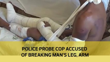 Police probe cop accused of breaking man's leg, arm