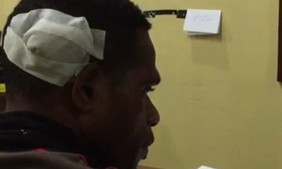 Anggota Polisi Terluka saat akan Lerai Pertikaian