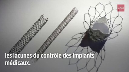 Les « Implant Files », nouveau scandale sanitaire ?