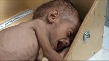 لوقف مجاعة اليمن.. منظمات إغاثية تطالب واشنطن بإنهاء الحرب
