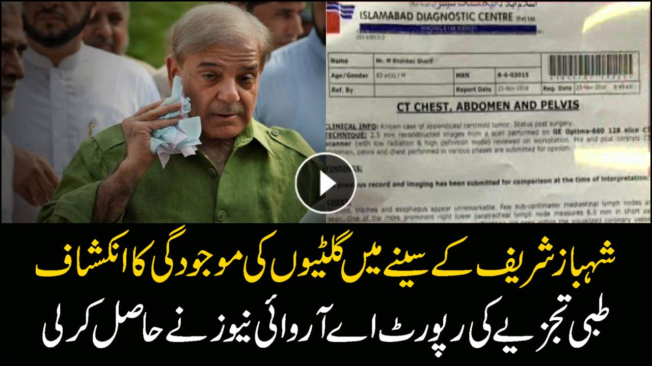 Few sub-centimeter mediastinal lymph nodes are seen in Shehbaz Sharif's body