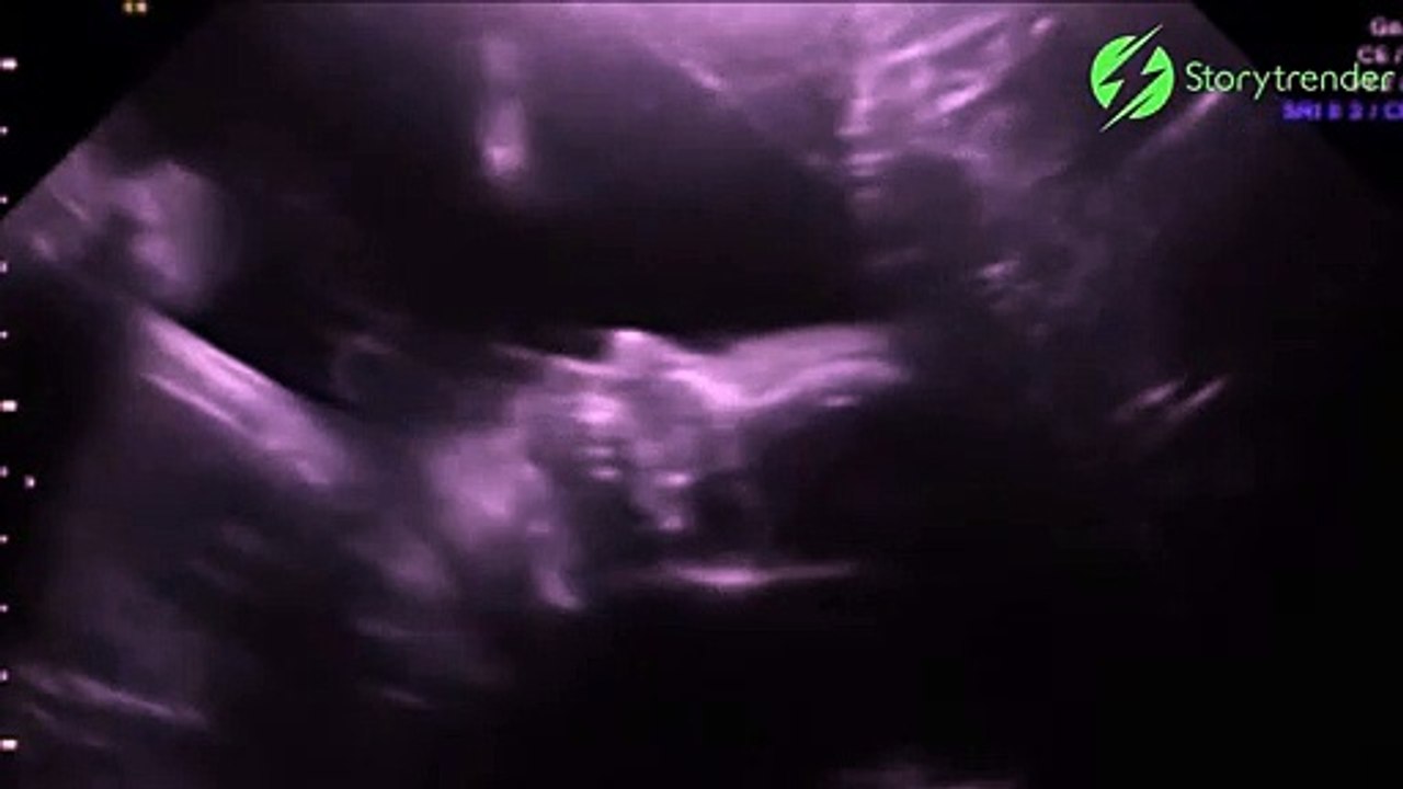 Son bébé lui fait coucou depuis l’intérieur du ventre... Adorable