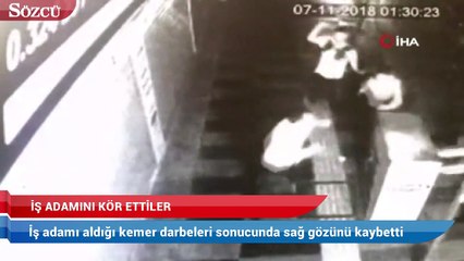 Nasıl tepki gösterirsin deyip iş adamını kör ettiler