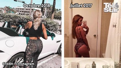 Fidji Ruiz : chirurgie, fessier, instagram, elle répond à Télé Star