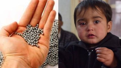 பெல்லட் குண்டால் தாக்கப்பட்ட 1 வயது சிறுமி.. குவியும் கண்டனம்!- வீடியோ