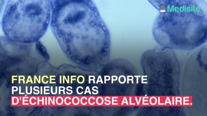 Maladie du Renard : attention si vous vous promenez dans les bois