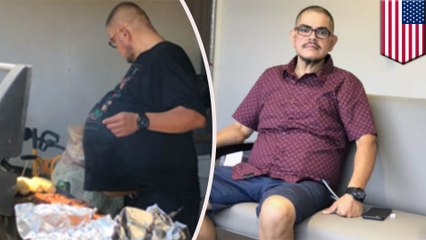 Man's beer belly was actually 77-pound cancerous tumor