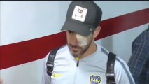 El capitán del Boca, herido en el ojo tras el ataque de los hinchas al autobús del equipo