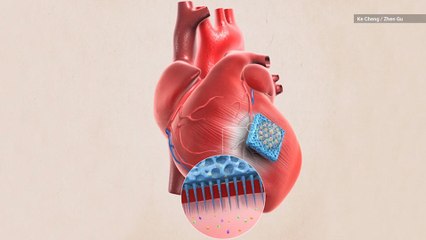 Needle-Covered Patch Could Help Heart Attack Survivors Heal