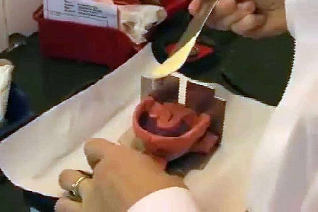 Was passiert beim Zahnabdruck