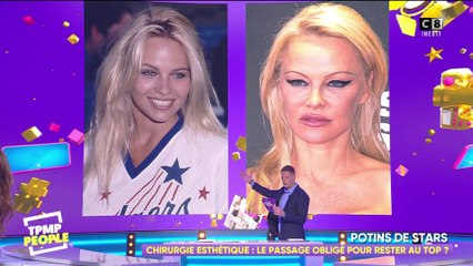 Les stars et la chirurgie esthétique : pour le meilleur et pour le pire !
