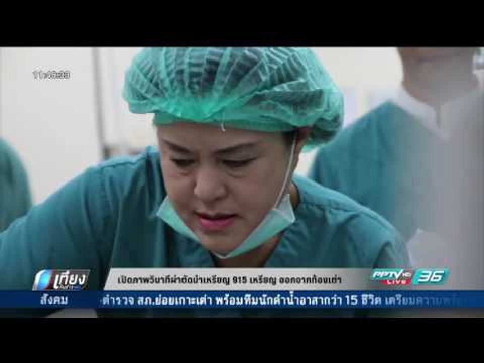 เปิดภาพวินาทีผ่าตัดนำเหรียญ 915 เหรียญ ออกจากท้องเต่า - เที่ยงทันข่าว