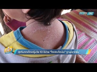 เช้าปลุกข่าว | ขยายประเด็นร้อน | 6 ก.พ. 61 (3/3)