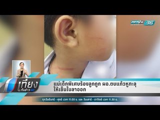 แม่เด็กพิเศษร้องลูกถูก ผอ.ตบแก้วหูทะลุ-ให้เซ็นใบลาออก - เที่ยงทันข่าว