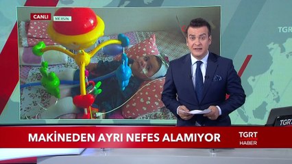 Makineden Ayrı Nefes Alamıyor