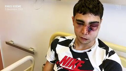 Un homme de 21 ans passé à tabac par les forces de l'ordre sur cette vidéo, la victime dépose plainte, une enquête ouverte