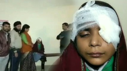 बेरहम शिक्षक ने डस्टर मारकर फोड़ी छात्रा की आंख, हॉस्पीटल में भर्ती कराकर सभी शिक्षक भाग निकले