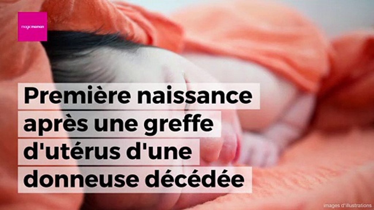 Première naissance d'un bébé après une greffe d'utérus d'une donneuse décédée