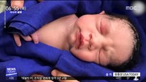 [이 시각 세계] 사망자 자궁 이식받은 여성 출산…'세계 최초'