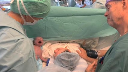 Brésil : 1ère naissance grâce à une greffe d'utérus d'une donneuse morte