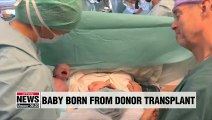 First baby born from uterus transplanted from dead donor about to celebrate 1st birthday