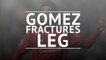 Joe Gomez suffers leg fracture against Burnley