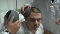 3d Yazıcı' Tekniğiyle Kafasına Titanyum Parça Takılan Hastanın İnanılmaz Değişimi