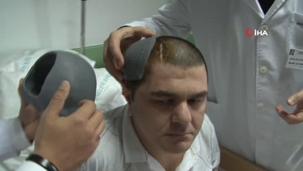 3d Yazıcı' Tekniğiyle Kafasına Titanyum Parça Takılan Hastanın İnanılmaz Değişimi