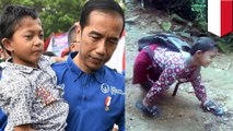 Adul bocah difabel yang viral akhirnya bertemu Jokowi - TomoNews