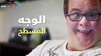 فيديو معلوماتي.. علامات يتميز بها المصابون بمتلازمة داون