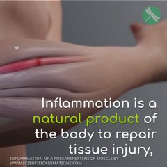 Remove These Foods To Fight Inflammation!