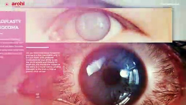 Best Eye Care Specialist Hospital in Oshiwara, Andheri West Mumbai - Arohi Eye Hospital