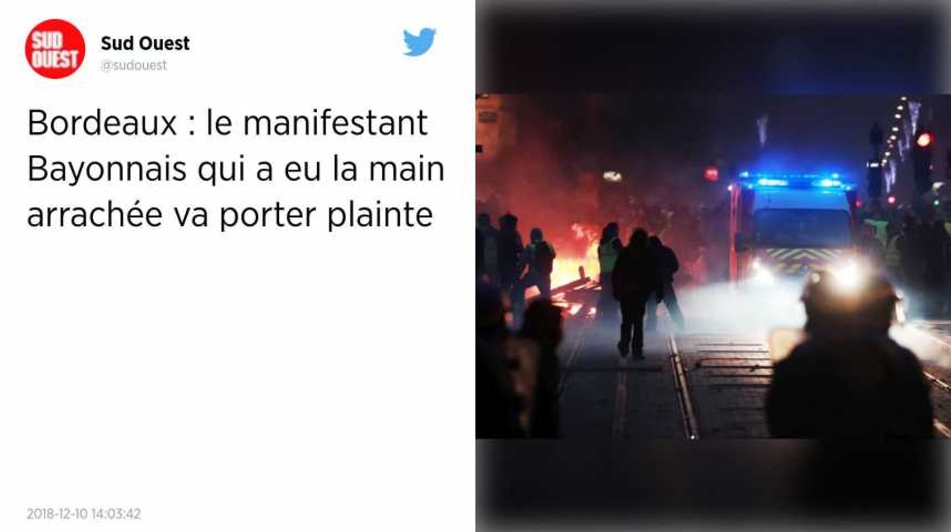 Gilets Jaunes Bordeaux Sa Main A été Arrachée Samedi Il Veut Porter Plainte