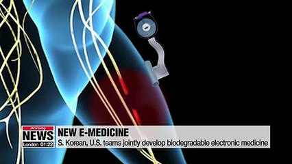 Electronic medicine that dissolves inside body developed