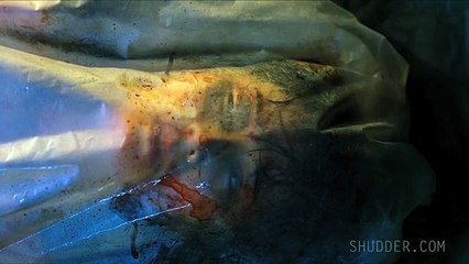 Hamiltons Pharmacopeia S01 E01