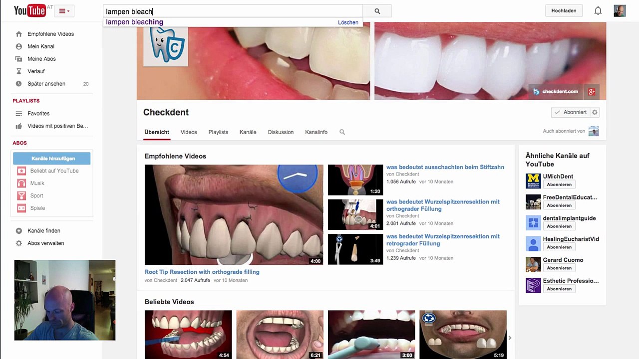 wieso Lampen Bleaching gefährlich ist