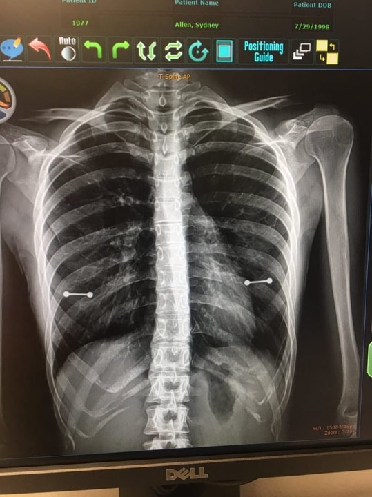 Cette maman découvre que sa fille a des piercings aux tétons de la plus dingue des façons