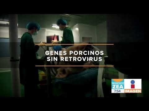 Quieren crear órganos en cerdos para hacer trasplantes para humanos | Noticias con Zea