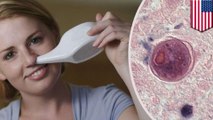 Wanita terjangkit amoeba pemakan otak setelah gunakan neti pot - TomoNews