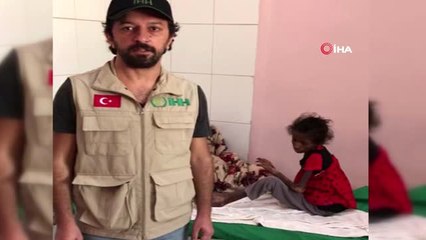 Yemen'de 21 Milyon İnsan Açlıkla Mücadele Ediyor