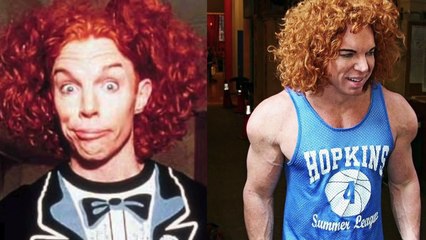 Top 10 Casos de Cirugías Plásticas Que Terminaron En Desastre