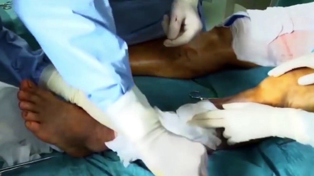 Les greffes d'organes d'animaux chez l'Homme se rapprochent !