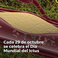 Día Mundial del Ictus.