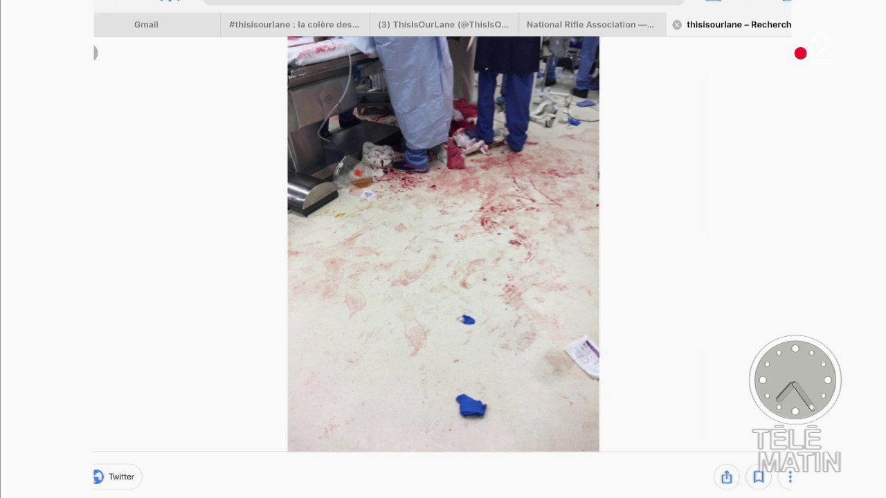 La colère des chirurgiens américains contre le lobby des armes