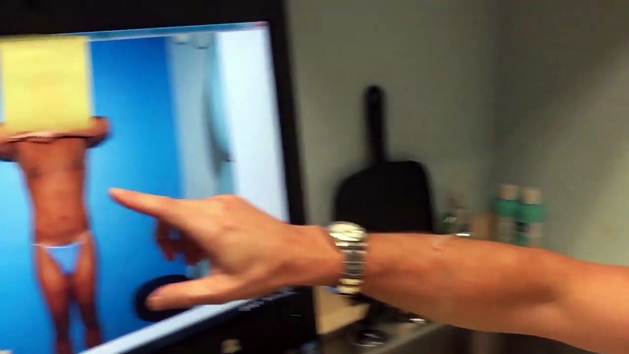 Body Banking With Ab Definition and Pec Implants - Male Plastic Surgery