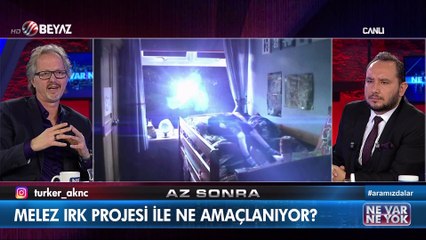 Uzaylılar tarafından yerleştirlen Microçipler (implants) şaşırttı!