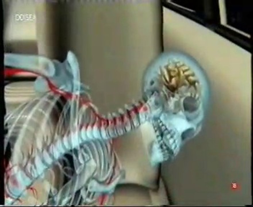 Estres: Muerte por airbag