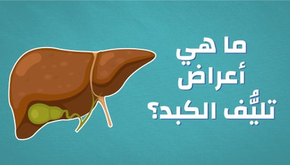 ما هي أعراض تليف الكبد
