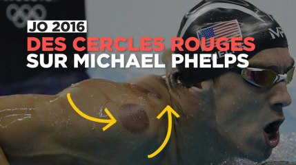 JO de Rio : les marques rouges sur le corps de Phelps ont une explication