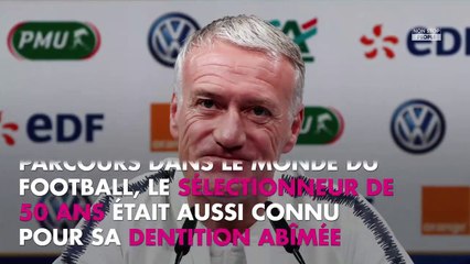 Didier Deschamps métamorphosé : son changement physique dévoilé
